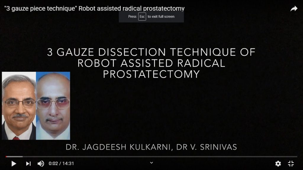 “3 gauze piece technique” Robot assisted radical Prostatectomy